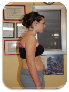 E.A. – 15 anni ½ - Disarmonia Posturale - Kineform