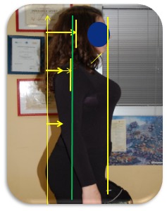 E.A. – 17 anni - Kineform 